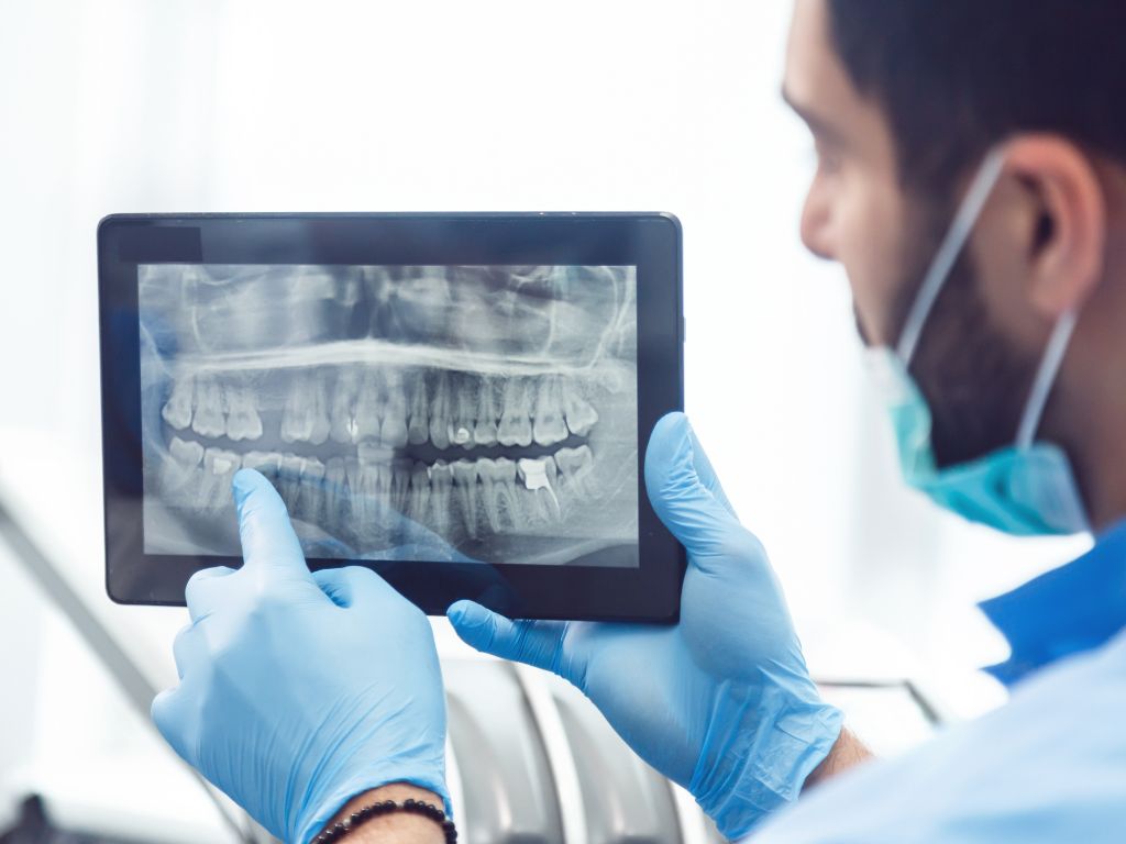 Do you ever wonder why you must get X-rays at the dentist’s office so often? Dentists need the valuable information X-rays display for each patient.