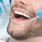 5 Advantages of Bioclear Treatment for Your Teeth