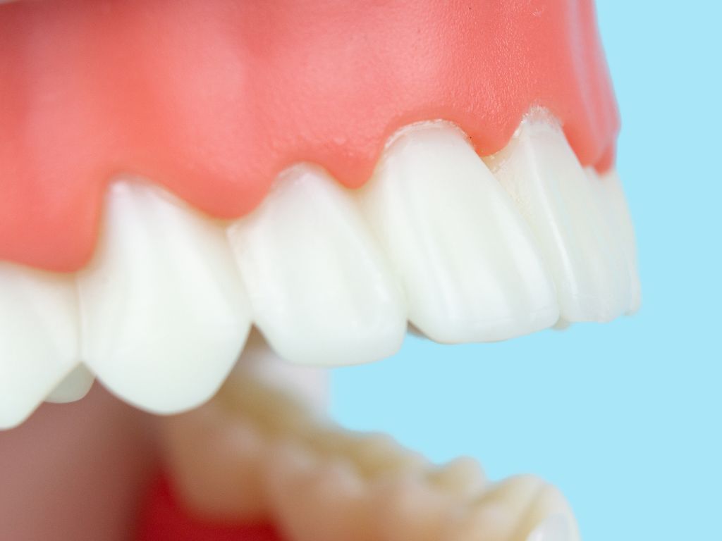Common Problems Patients Have With Snap-On Dentures