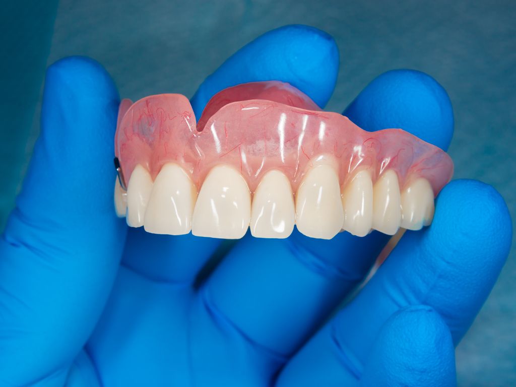 Post-Placement Care for Snap-on Denture Implant Patients