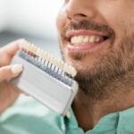 How Porcelain Veneers Are Matched to Your Teeth Color