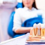 A dental implant model sits on a tray beside tools, with a blurred patient and dentist in the background.