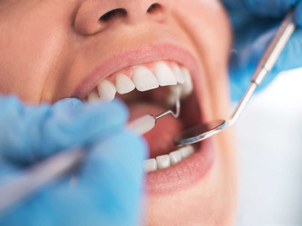 4 Benefits of Cosmetic Dental Health Care