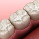 A Look Into Preventive Dental Care and Treatments